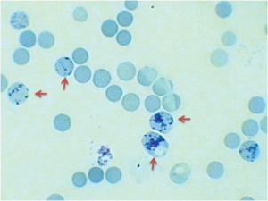 Wright S Stain Preparation Principle Procedure And Results