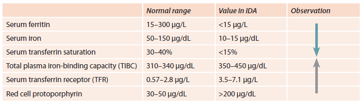 Laboratory Diagnosis Of Iron Deficiency Anemia IDA 