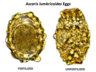 Eggs-of-Ascaris-Lumbricoides