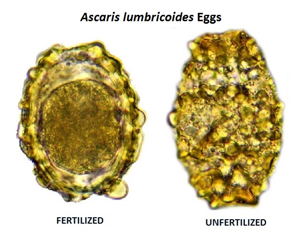 Ascaris Lumbricoides Roundworm Eggs Morphology Characteristics And 