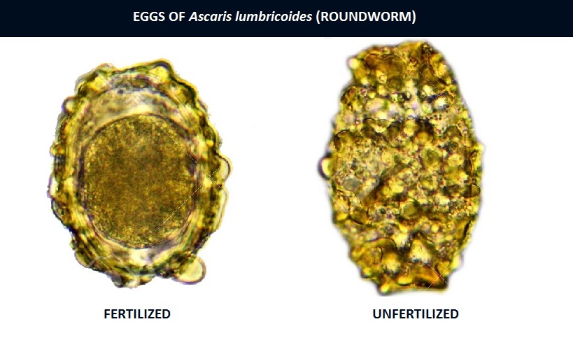Ascaris Lumbricoides Roundworm Eggs Morphology Characteristics And 