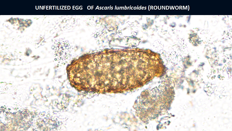 Unfertilized-Egg-of-Roundworm