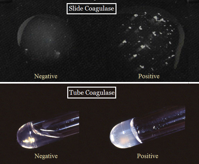 staphylococcus aureus catalase test