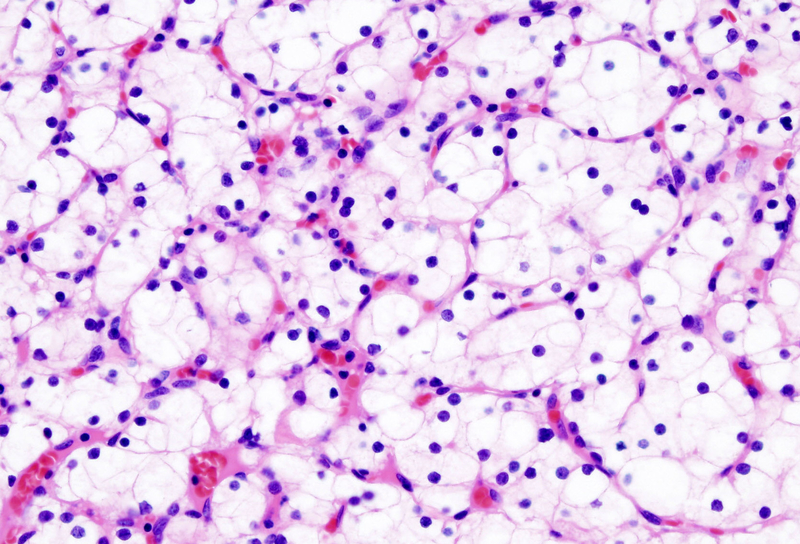 Hematoxylin And Eosin H E Staining Of Uncleared Tissue Left And | Sexiz Pix