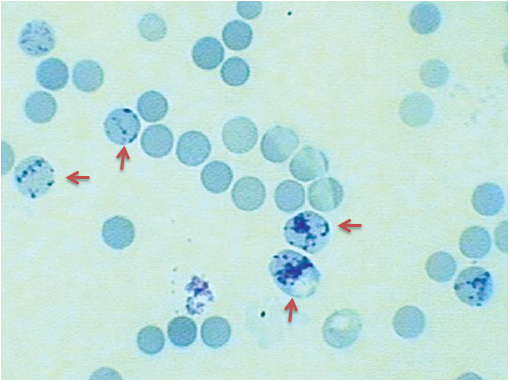 Reticulocyte-Count