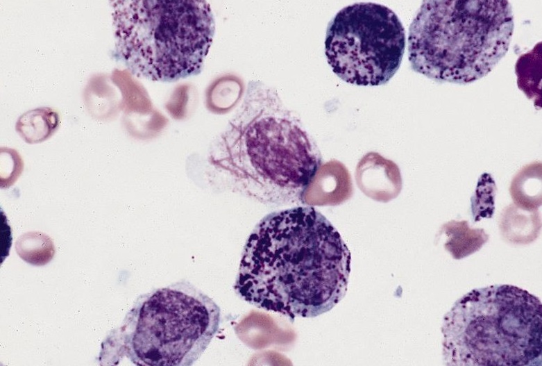 basophil metachromatic stain