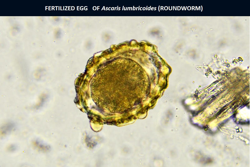 Fertilized-Egg-of-Ascaris-Lumbricoides