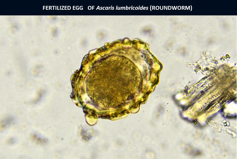 Ascaris Lumbricoides Fertilized Egg