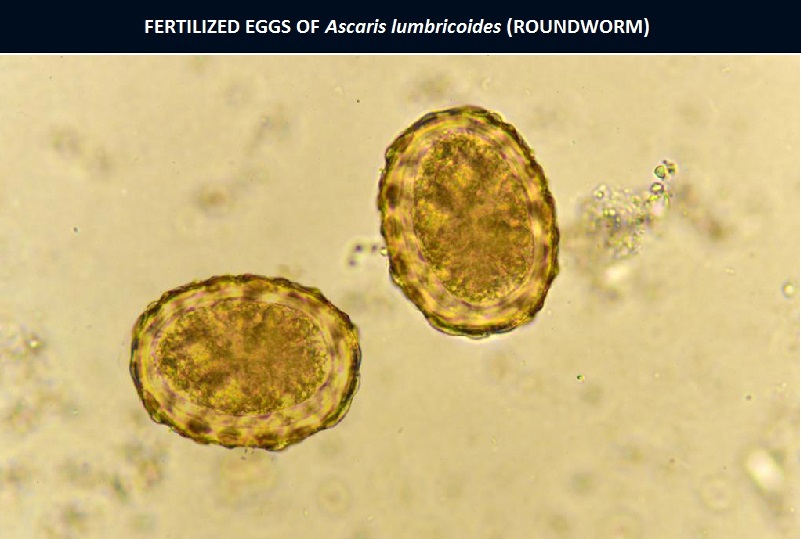 roundworm eggs in humans