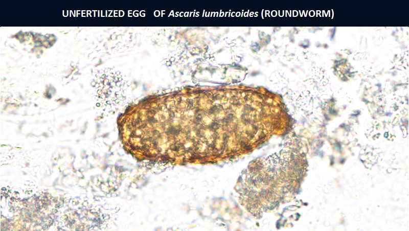 ascaris lumbricoides larvae