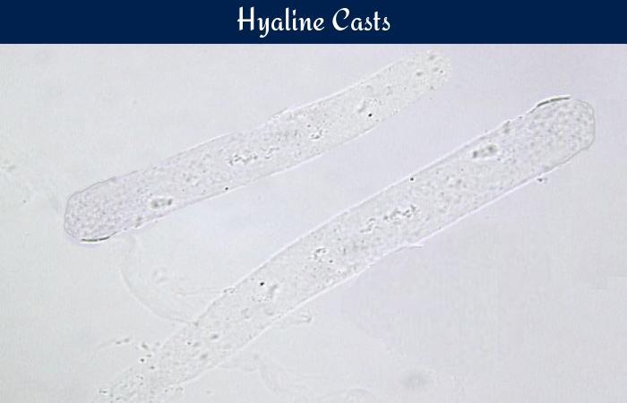 Hyaline-casts