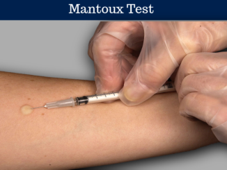 Mantoux-Test
