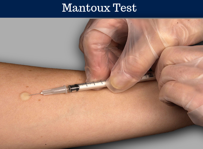 HEMATOLOGY Archives | LaboratoryTests.org