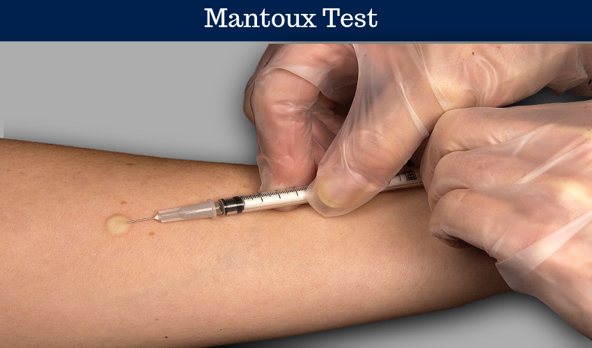 Mantoux-Test