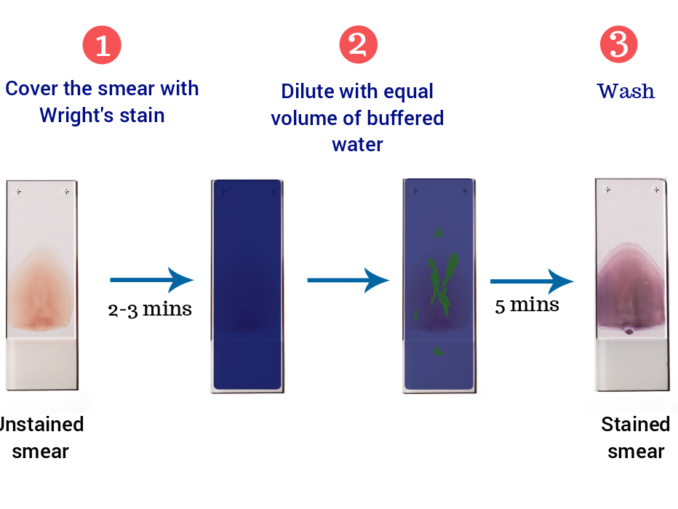 Principle Of Hematoxylin And Eosin Staining Archives 