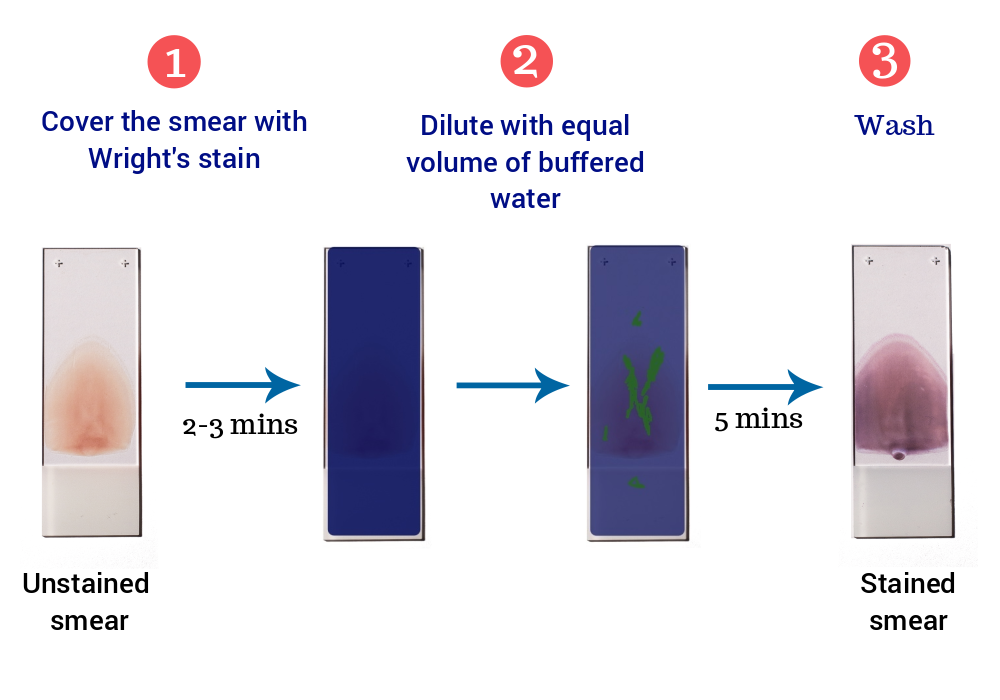 Main components of the Diff-Quik staining method: fixative