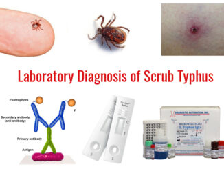 laboratory-diagnosis-scrub-typhus
