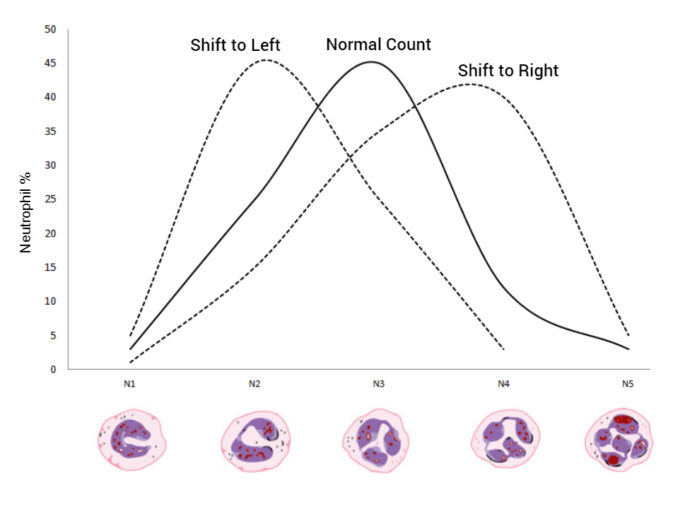 Reticulocyte Count : Principle, Procedure, Calculations And Clinical ...