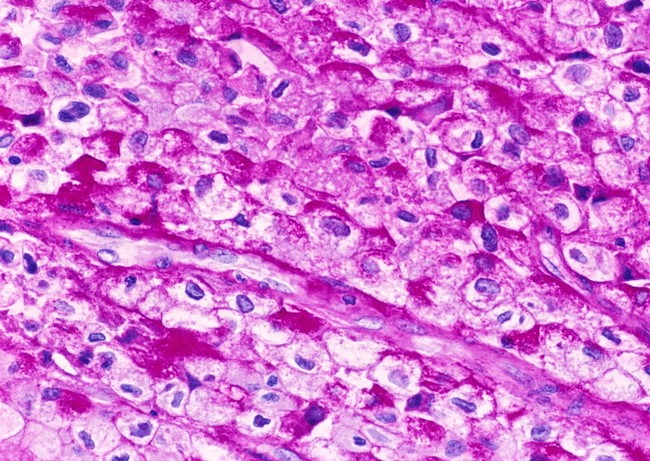 PAS-staining